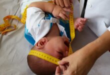INSS indeniza crianças com zika em ação histórica de saúde