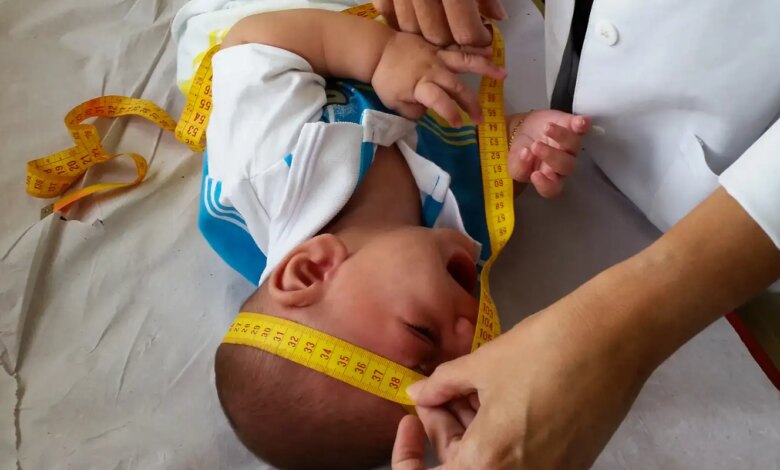 INSS indeniza crianças com zika em ação histórica de saúde