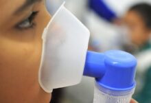 Fiocruz estima que 72,5% de óbitos por SRAG são relacionados à influenza A