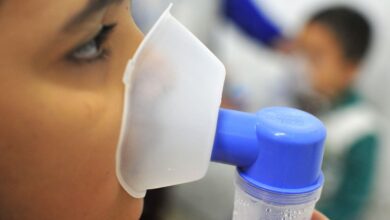 Fiocruz estima que 72,5% de óbitos por SRAG são relacionados à influenza A