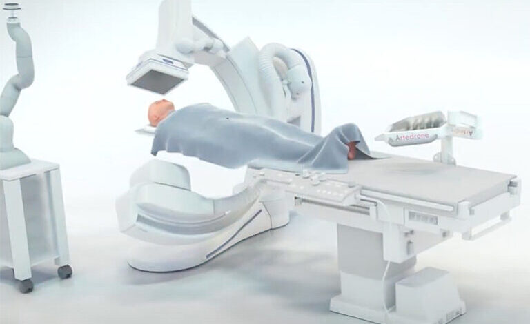 Sistema de robô flutuante realiza trombectomia autônoma