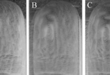 Images of topographical skin wrinkles overlaid on each other from the two different time points 24 h apart, with opacity levels of (A) 0%, (B) 50%, (C) 100%. Image credit: Guy German.