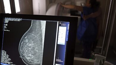 Ministério da Saúde promove pesquisa sobre câncer de mama