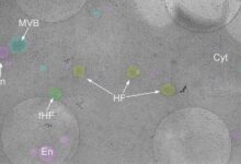Hemifusomes: Biologists Discover Previously Unknown Organelle Complexes inside Human Cells