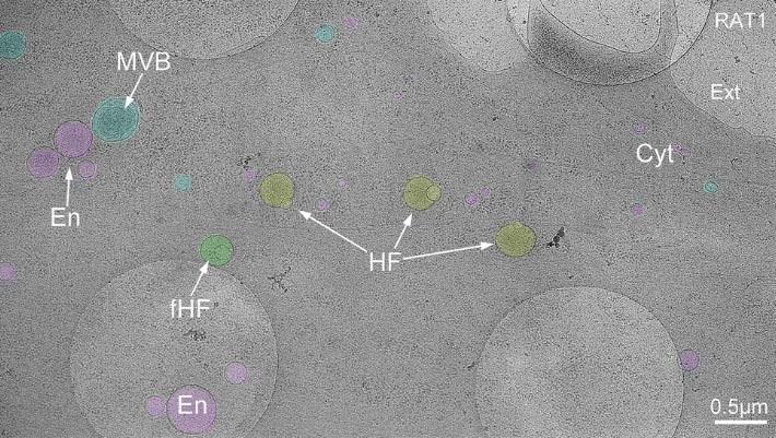 Hemifusomes: Biologists Discover Previously Unknown Organelle Complexes inside Human Cells