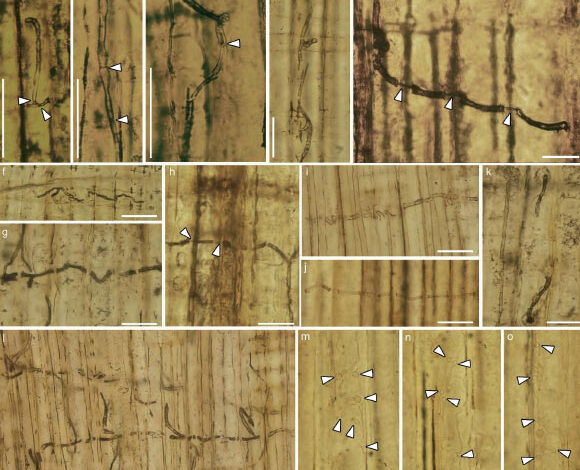 Blue-stain fungus in wood tissues of Xenoxylon phyllocladoides from the Jurassic of western Liaoning province, China. Image credit: Tian et al., doi: 10.1093/nsr/nwaf160.