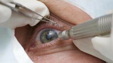 SUS restringe cirurgia de mudança de cor dos olhos para cegos