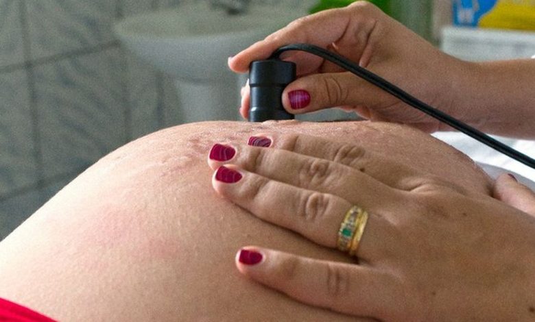 Exame pré-natal do SUS reduz risco de anomalias em bebês