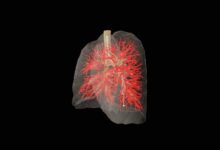 Modelos de AI aprimoram manuseio de agulhas médicas