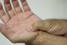 SUS reconhece fibromialgia como deficiência em todo o país