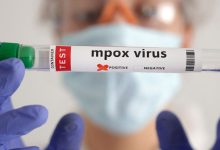 Ministério da Saúde monitora 50 mil casos de Mpox na África