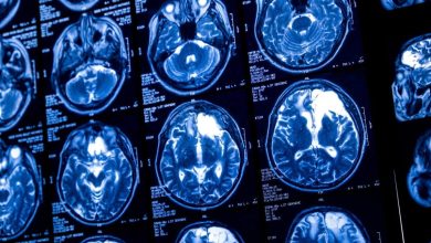 Sam Altman lança startup de chip cerebral para rivalizar com Neuralink