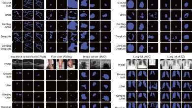 CNN aprende a ler imagens médicas com menos dados