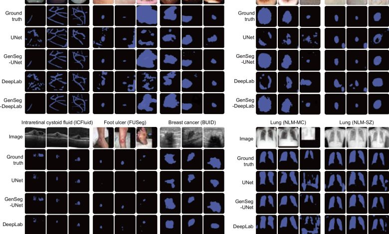 CNN aprende a ler imagens médicas com menos dados
