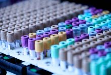 Como criar experimentos de machine learning eficazes