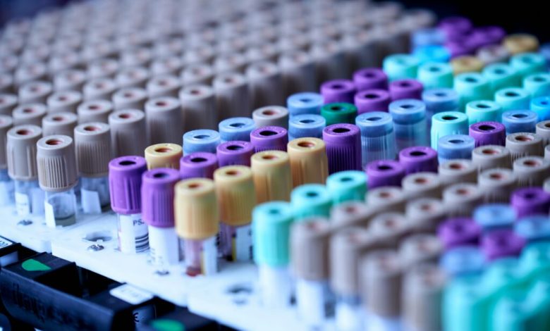 Como criar experimentos de machine learning eficazes