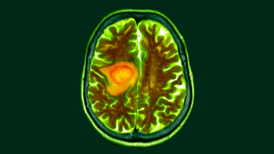 Pesquisa indica que dieta pode facilitar tratamento do câncer cerebral