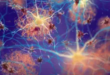 Pesquisa identifica sinais ocultos de Alzheimer em pacientes com Parkinson