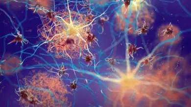Pesquisa identifica sinais ocultos de Alzheimer em pacientes com Parkinson