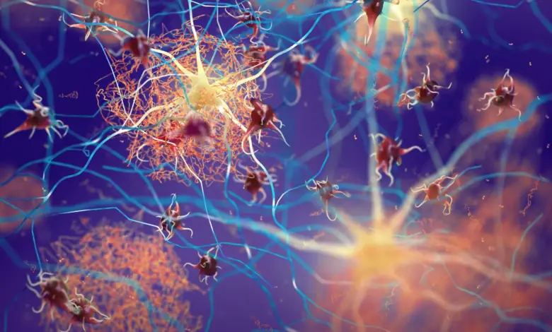 Pesquisa identifica sinais ocultos de Alzheimer em pacientes com Parkinson