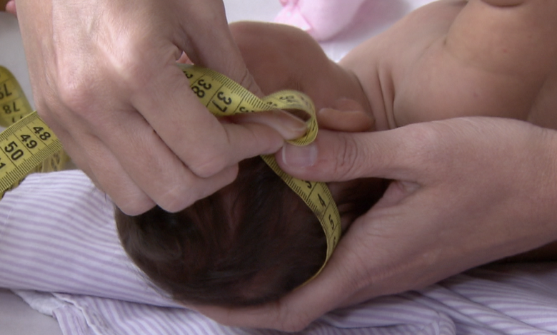 SUS regulamenta indenização a vítimas do vírus Zika