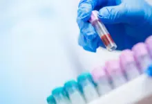 Tecnologia de IA revela diagnósticos vitais em hemogramas