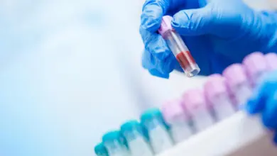 Tecnologia de IA revela diagnósticos vitais em hemogramas