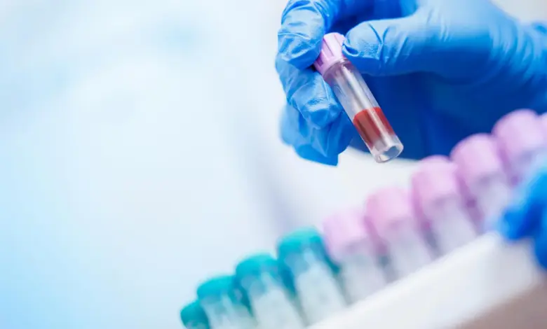 Tecnologia de IA revela diagnósticos vitais em hemogramas