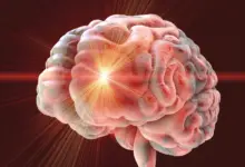 Pesquisa identifica sinal cerebral precoce do Alzheimer