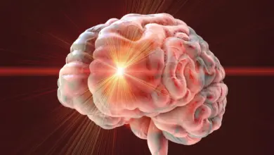Pesquisa identifica sinal cerebral precoce do Alzheimer