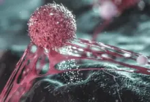 Pesquisa revela que células cancerígenas ficam mais agressivas sob pressão