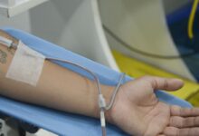 Sociedade de Reumatologia propõe mais centros de infusão no SUS