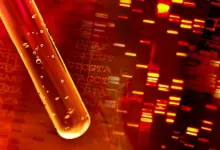 Estudo identifica mesotelioma oculto com exame de sangue