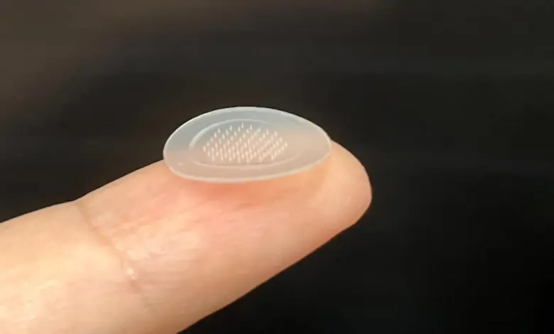 Estudo aponta eficácia de novo patch contra acne em 7 dias
