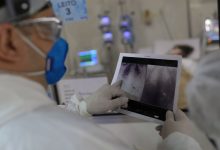 Covid causa maior número de internações em hospitais do Rio