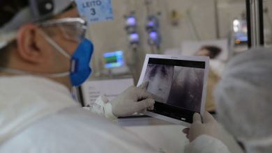 Covid causa maior número de internações em hospitais do Rio