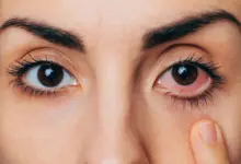 Pesquisa indica que 50% dos adultos têm olhos secos
