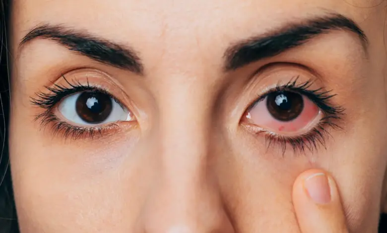 Pesquisa indica que 50% dos adultos têm olhos secos