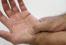 SUS propõe política para pacientes reumáticos inovadora