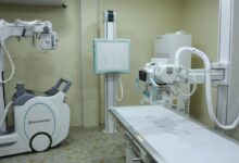 SUS realiza 60% dos exames de imagem no Brasil, aponta pesquisa