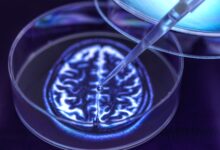 Pesquisa revela dúvidas sobre uso de minibrains conscientes