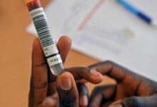 Cientistas revelam relatório sobre química tóxica e impacto na cultura