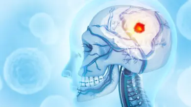 Pesquisa revela câncer cerebral que consome o crânio