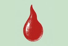 Pesquisa aponta teste de sangue para detecção precoce de câncer