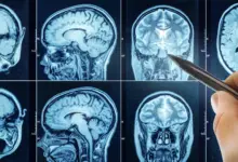 Estudo liga sono inadequado ao envelhecimento cerebral