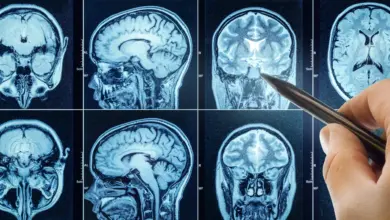 Estudo liga sono inadequado ao envelhecimento cerebral