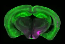 Cientistas identificam circuito cerebral que desativa dor crônica