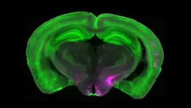 Cientistas identificam circuito cerebral que desativa dor crônica