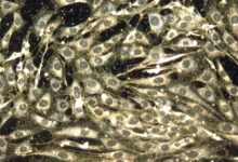 Estudo testa nanopartículas para reduzir danos da quimioterapia
