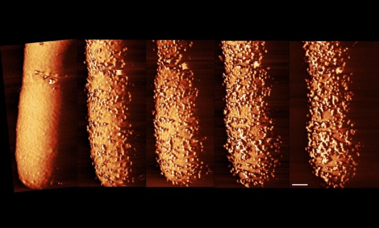 Pesquisa revela ação de antibiótico matando bactérias